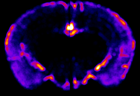 Brain activity mapping during sweep stimulus (blurred)