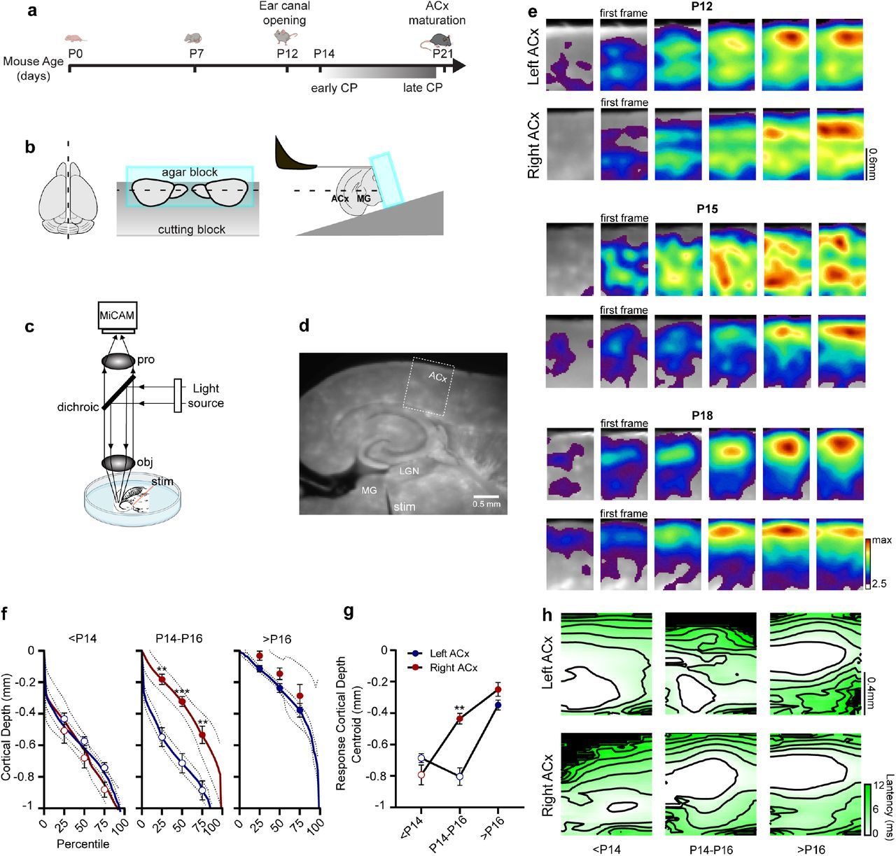 Figure 1 from the paper shows differences in thalamocortical input maturation between the left and right auditory cortex (ACx) across developmental stages, using bilateral slice preparation and voltage-sensitive dye imaging.