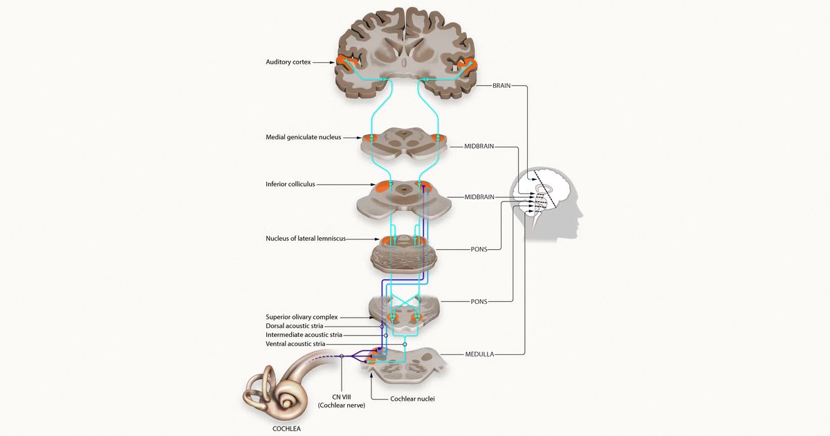 Sound information moves through the cochlea to the brain.